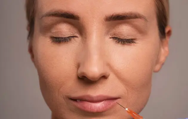 lowerrface-wrinkle-injections