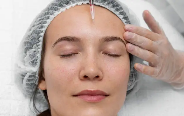 upperface-wrinkle-injections