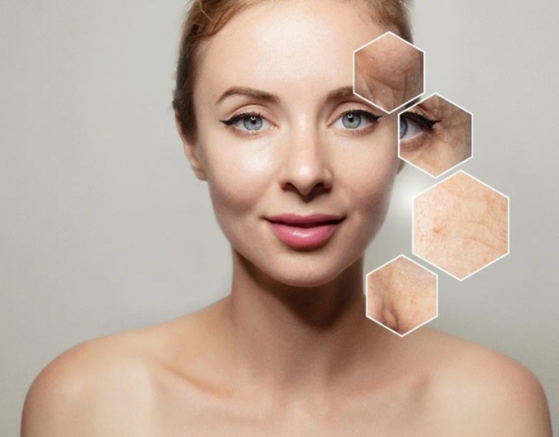 Close-up of a person’s upper body with skin texture samples, representing facial aesthetics treatments and the best anti-ageing wrinkle treatments