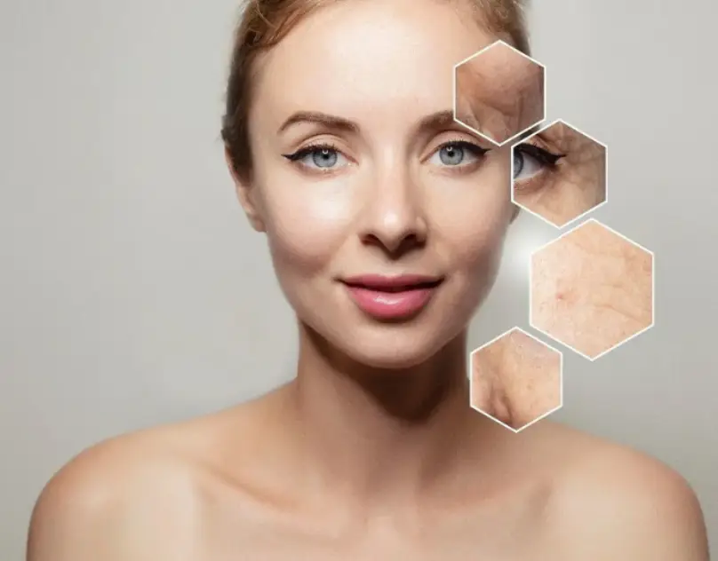 Close-up of a person’s upper body with skin texture samples, representing facial aesthetics treatments and the best anti-ageing wrinkle treatments